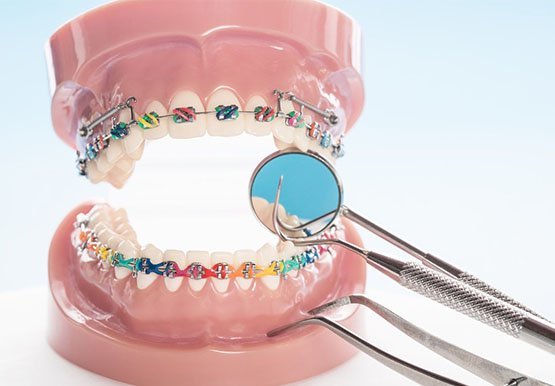 orthodontics-leichhardt