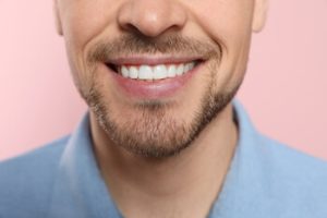 dental concerns teeth cracks leichhardt